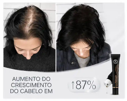 Repair Hair® - Crecimiento Capilar y Combate la Caída del Cabello