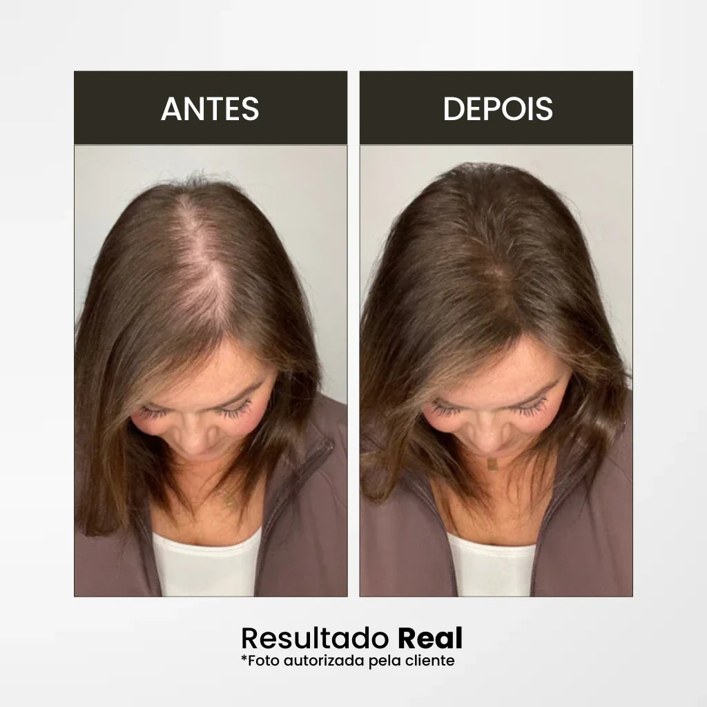 Corrector Capilar | Solución Instantánea para Fallas y Canas