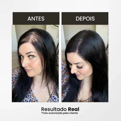 Corrector Capilar | Solución Instantánea para Fallas y Canas