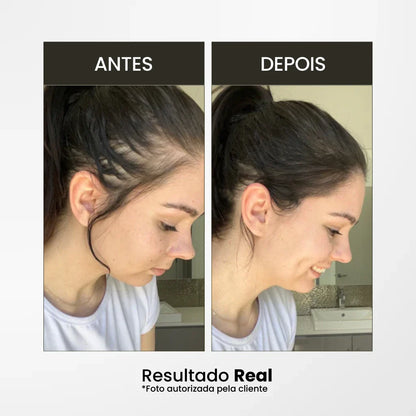 Corrector Capilar | Solución Instantánea para Fallas y Canas