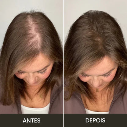 Toppik Hair: Fibra Capilar para Cobertura Instantánea