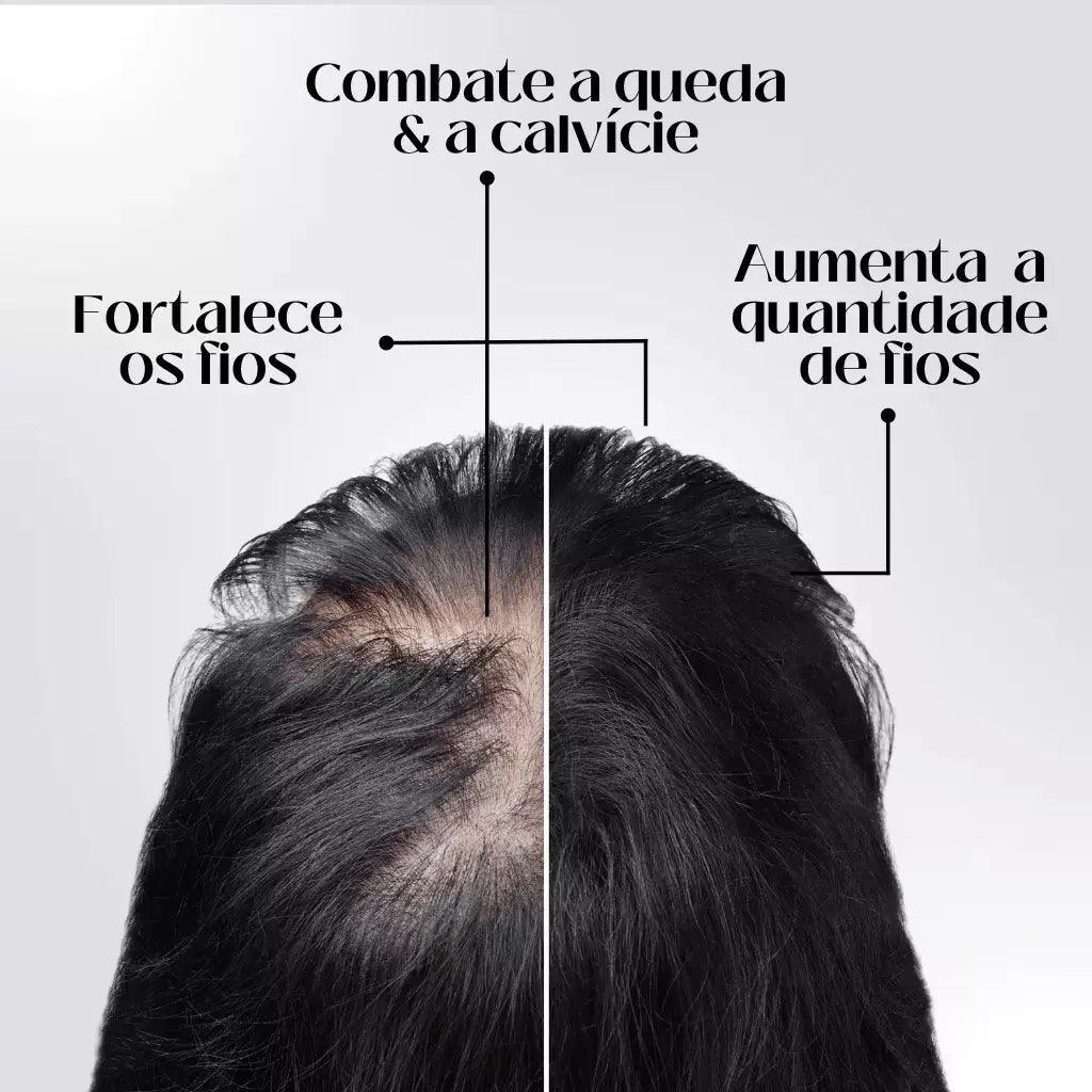 Repair Hair® - Crecimiento Capilar y Combate la Caída del Cabello