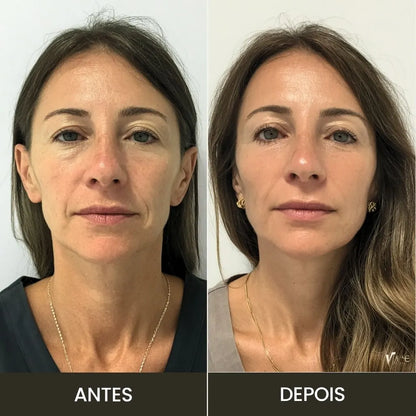 AGE Booster Pro: Dispositivo Coreano de Cuidado Facial