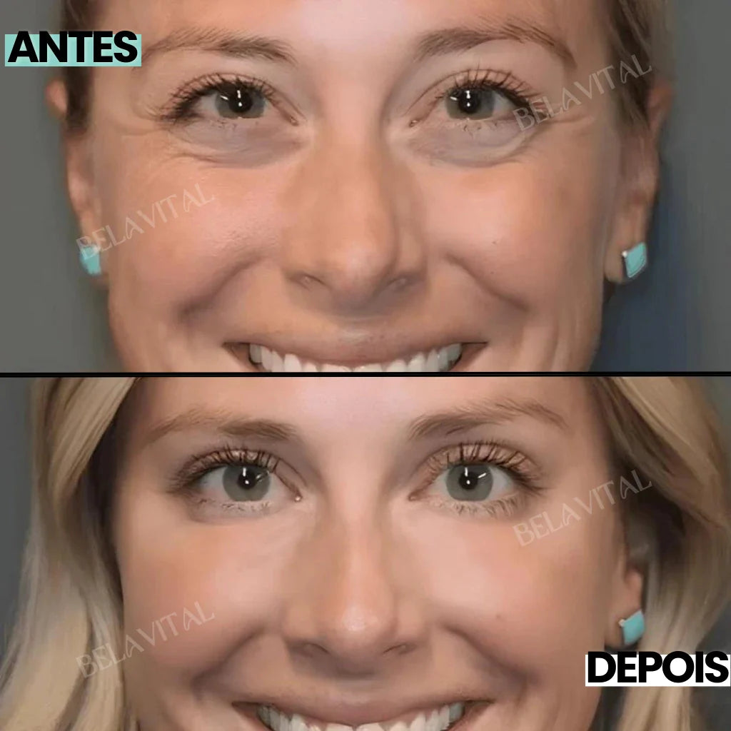 Celyn: Crema para Ojeras y Rejuvenecimiento Ocular Avanzado