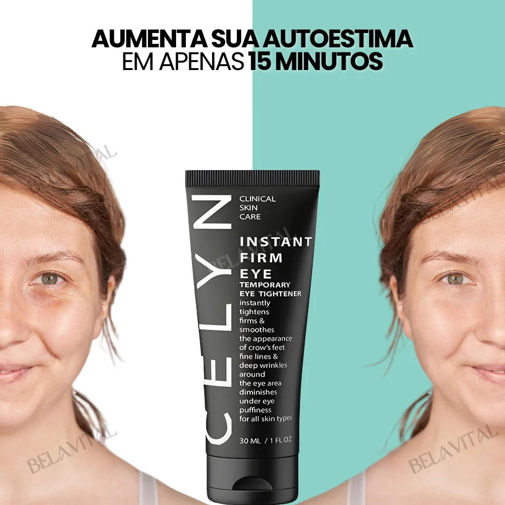 Celyn: Crema para Ojeras y Rejuvenecimiento Ocular Avanzado