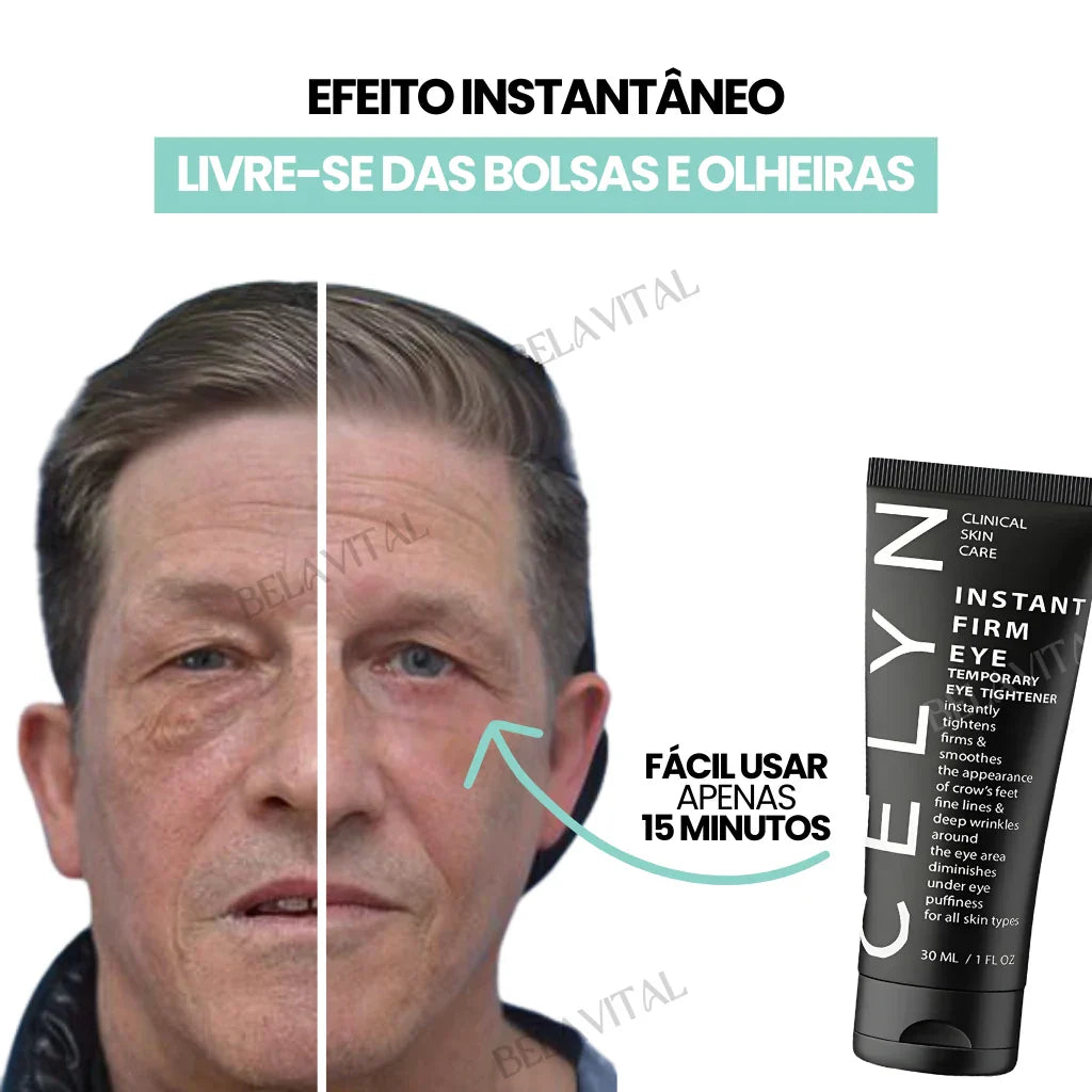 Celyn: Crema para Ojeras y Rejuvenecimiento Ocular Avanzado