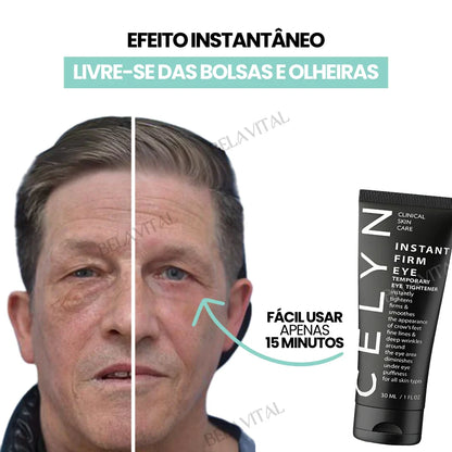 Celyn: Crema para Ojeras y Rejuvenecimiento Ocular Avanzado