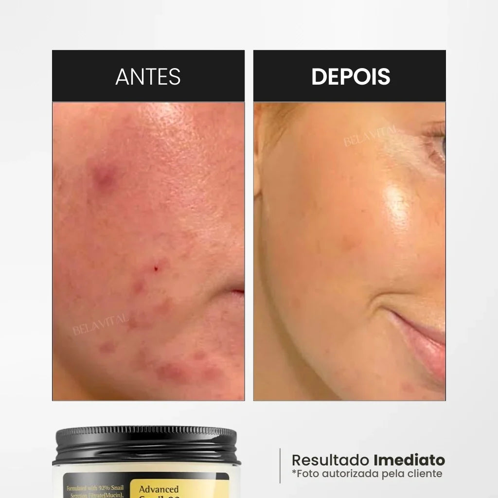 Crema Coreana de Baba de Caracol
