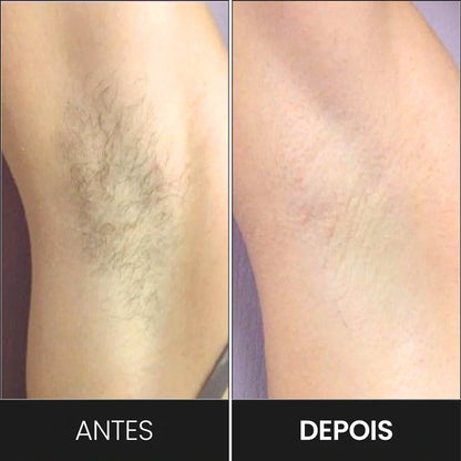 Depiladora IPL BelaVital + 2 Regalos