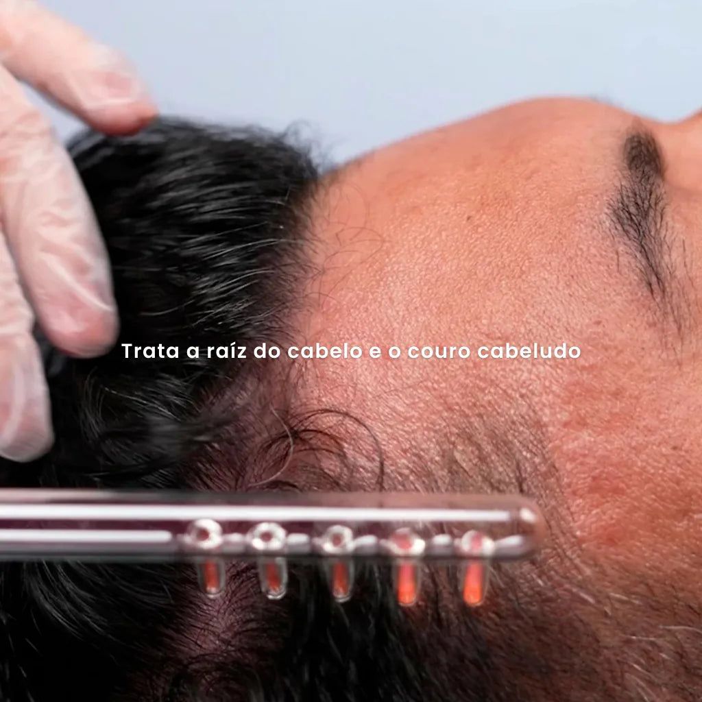 Electrodo Peine 5 Dientes P/ Alta Frecuencia | Derma Capilar™