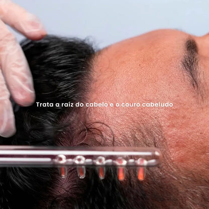Electrodo Peine 5 Dientes P/ Alta Frecuencia | Derma Capilar™