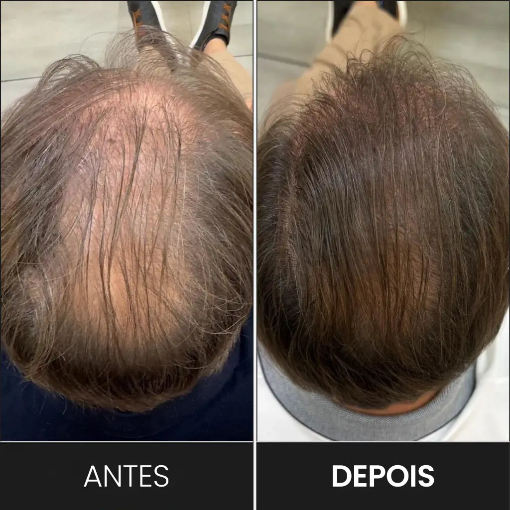 FEG Plus+: Spray de Crecimiento Capilar Intensivo