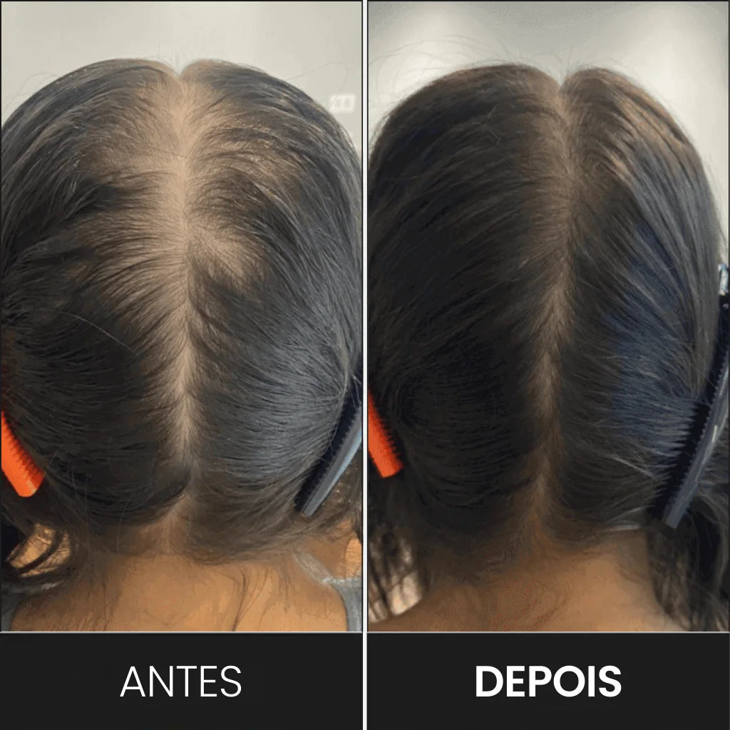 FEG Plus+: Spray de Crecimiento Capilar Intensivo