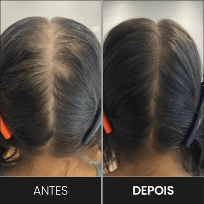 FEG Plus+: Spray de Crecimiento Capilar Intensivo