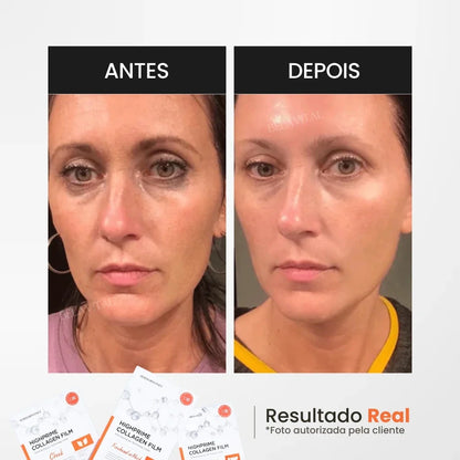 Kit Máscara de Colágeno GoldBotox Highprime: Renovación Profunda de la Piel