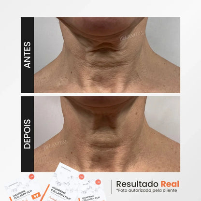 Kit Máscara de Colágeno GoldBotox Highprime: Renovación Profunda de la Piel