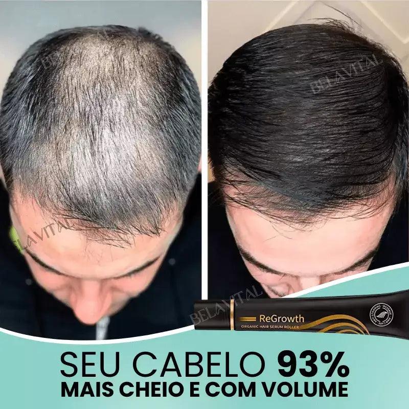 Kit Repair Hair Pro+ con Regalo Exclusivo: ¡El Tratamiento Más Completo Contra la Caída del Cabello y la Calvicie!
