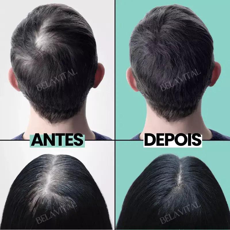 Kit Repair Hair Pro+ con Regalo Exclusivo: ¡El Tratamiento Más Completo Contra la Caída del Cabello y la Calvicie!