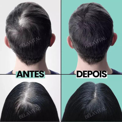 Kit Repair Hair Pro+ con Regalo Exclusivo: ¡El Tratamiento Más Completo Contra la Caída del Cabello y la Calvicie!