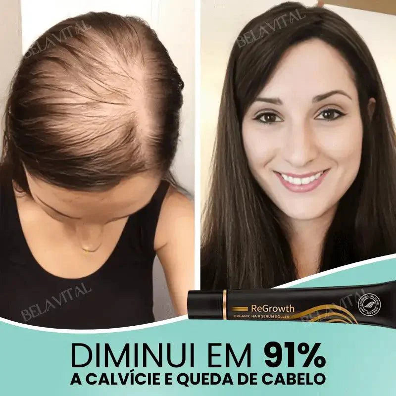 Kit Repair Hair Pro+ con Regalo Exclusivo: ¡El Tratamiento Más Completo Contra la Caída del Cabello y la Calvicie!
