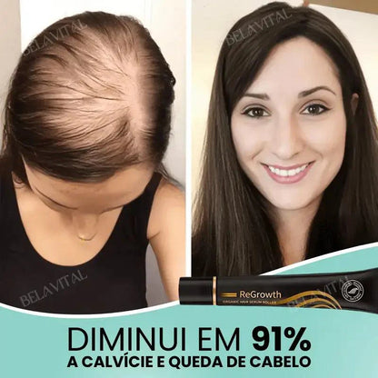 Kit Repair Hair Pro+ con Regalo Exclusivo: ¡El Tratamiento Más Completo Contra la Caída del Cabello y la Calvicie!