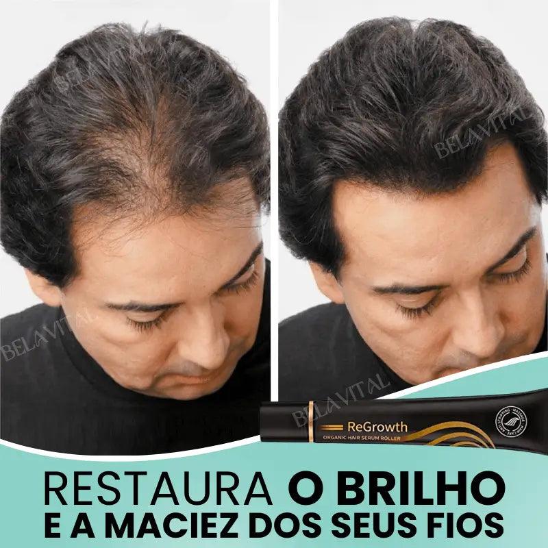 Kit Repair Hair Pro+ con Regalo Exclusivo: ¡El Tratamiento Más Completo Contra la Caída del Cabello y la Calvicie!