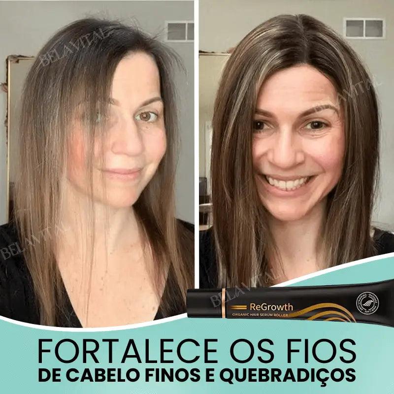Kit Repair Hair Pro+ con Regalo Exclusivo: ¡El Tratamiento Más Completo Contra la Caída del Cabello y la Calvicie!