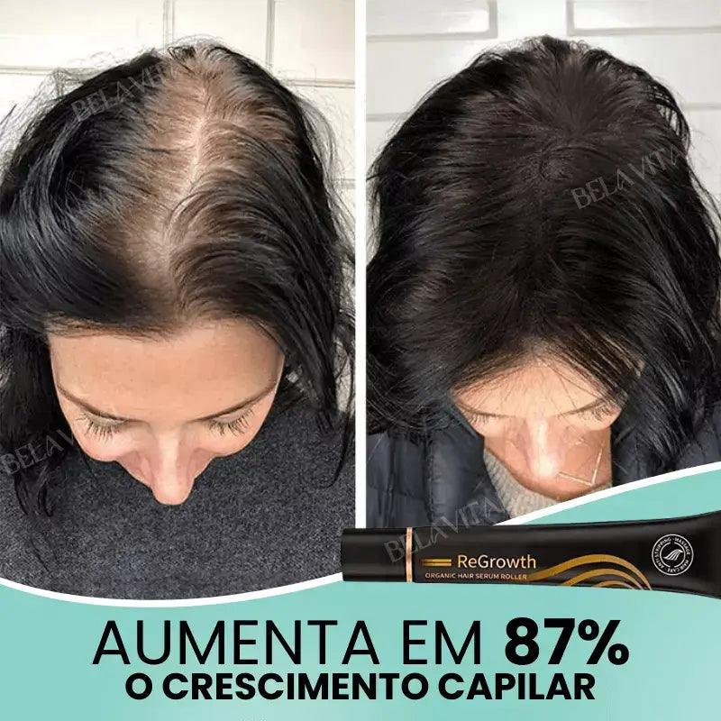 Kit Repair Hair Pro+ con Regalo Exclusivo: ¡El Tratamiento Más Completo Contra la Caída del Cabello y la Calvicie!