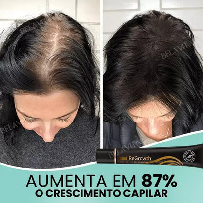 Kit Repair Hair Pro+ con Regalo Exclusivo: ¡El Tratamiento Más Completo Contra la Caída del Cabello y la Calvicie!