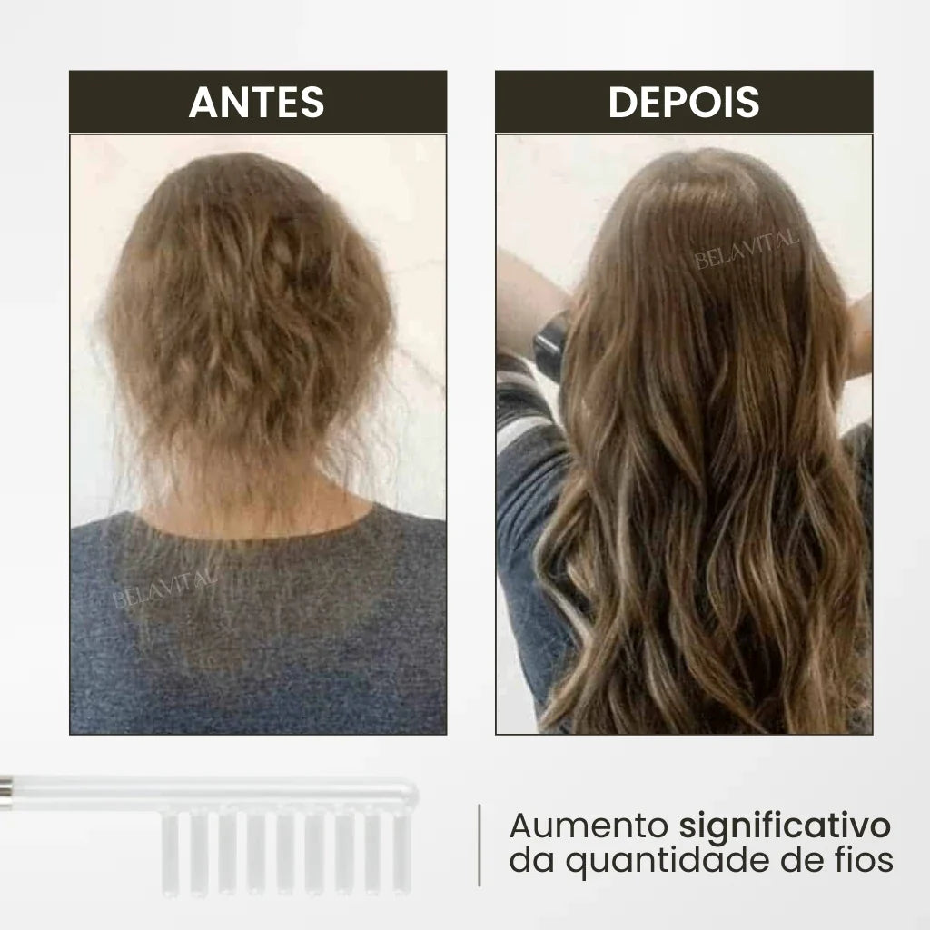 Cepillo de Alta Frecuencia: Innovación para Revitalización Capilar