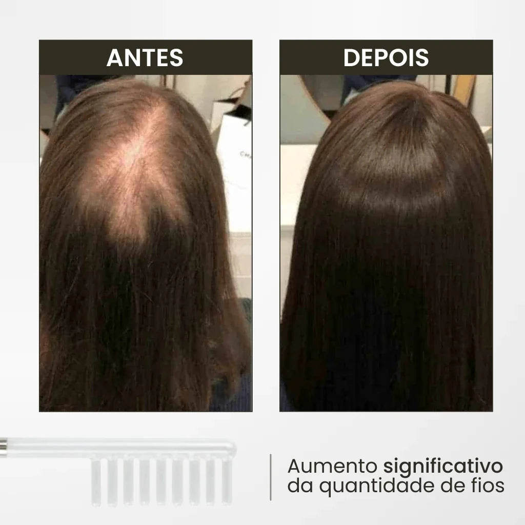 Cepillo de Alta Frecuencia: Innovación para Revitalización Capilar