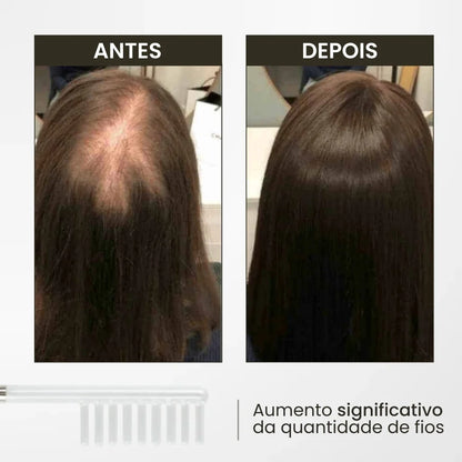 Cepillo de Alta Frecuencia: Innovación para Revitalización Capilar
