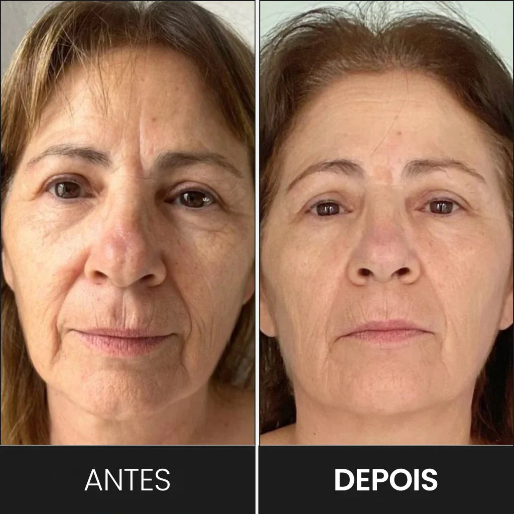 Masajeador y Modelador Facial LED: Reduce Arrugas y Papada