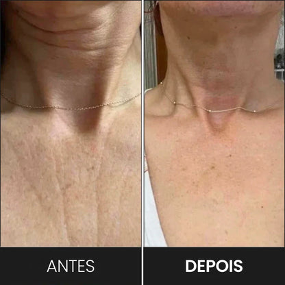 Masajeador y Modelador Facial LED: Reduce Arrugas y Papada
