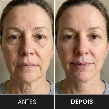 Masajeador y Modelador Facial LED: Reduce Arrugas y Papada