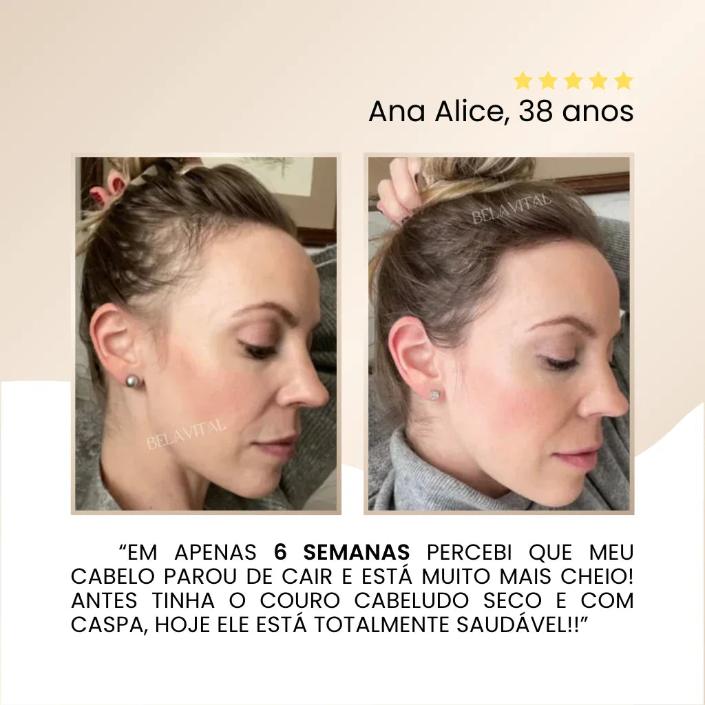 Repair Hair Therapy: Tratamiento Anticaída 3 en 1