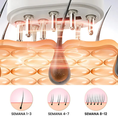 Repair Hair Therapy: Tratamiento Anticaída 3 en 1