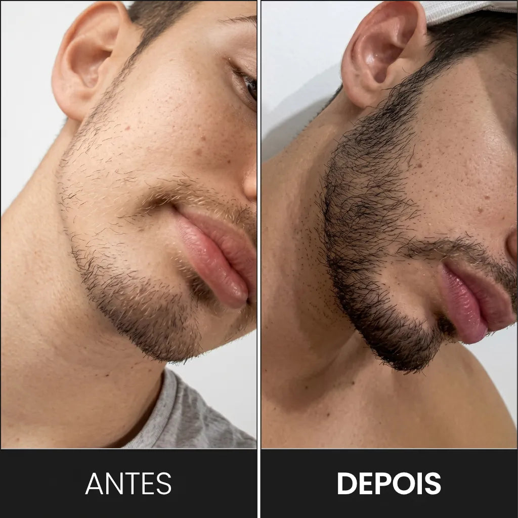 DermaRoller: Piel, Cabello y Barba en 1 solo producto