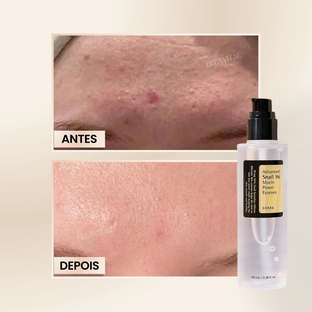 Sérum Coreano Advanced Snail 96: Reparación con Mucina de Caracol