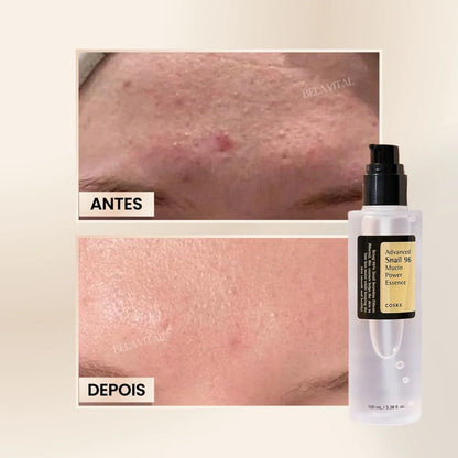 Sérum Coreano Advanced Snail 96: Reparación con Mucina de Caracol