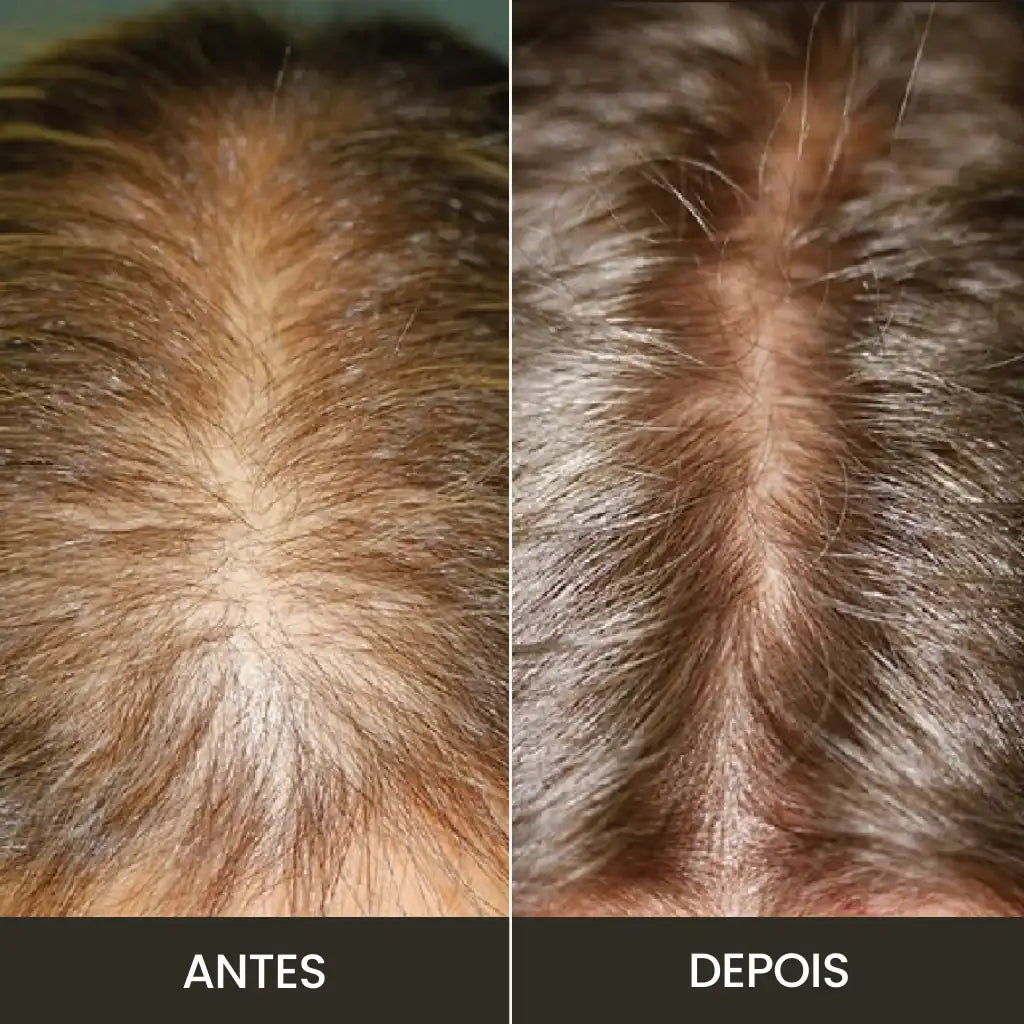 Kit Premium Hair: Fortalece y Crece - Completo