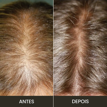 Kit Premium Hair: Fortalece y Crece - Completo