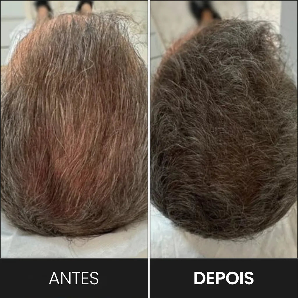 PurcPure Hair Brown: Shampoo en Barra para Oscurecer el Cabello Blanco