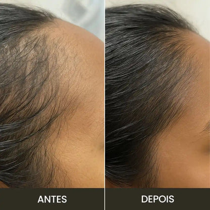 Kit Premium Hair: Fortalece y Crece - Completo
