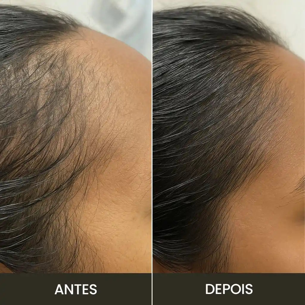 Kit Hair: Fortalece y Crece