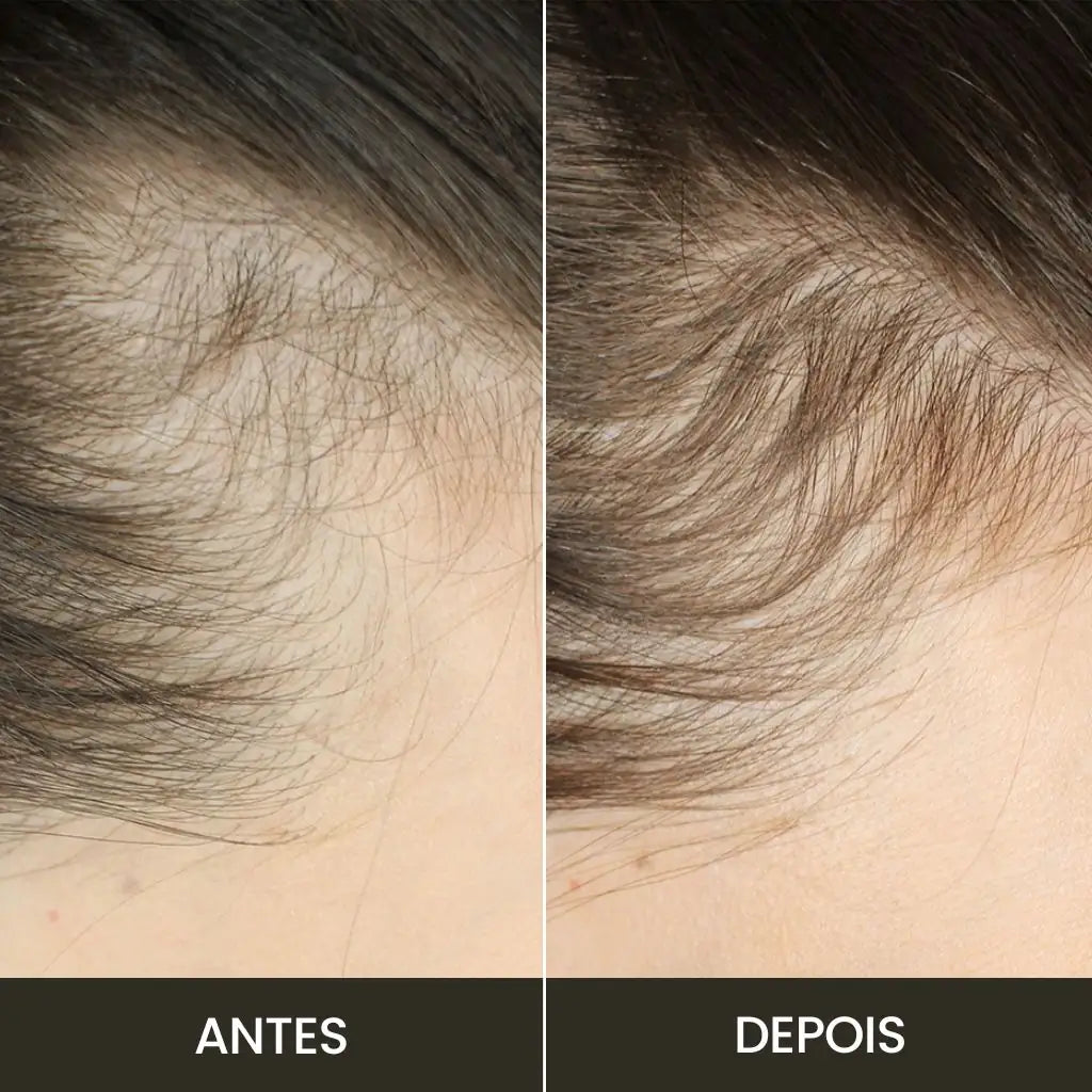 Kit Hair: Fortalece y Crece
