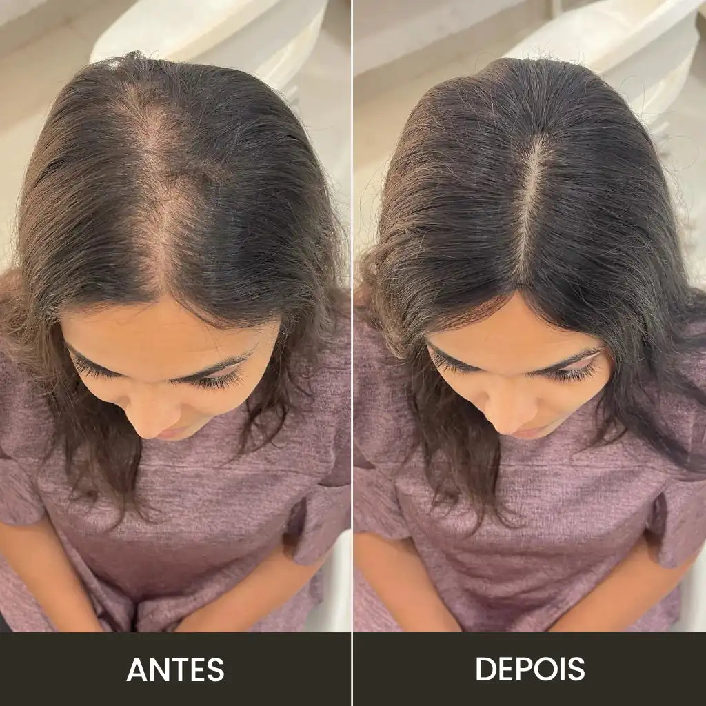Top Closure - Tope de Cabello Natural con Flequillo 45cm | Para Alopecia y Fallas