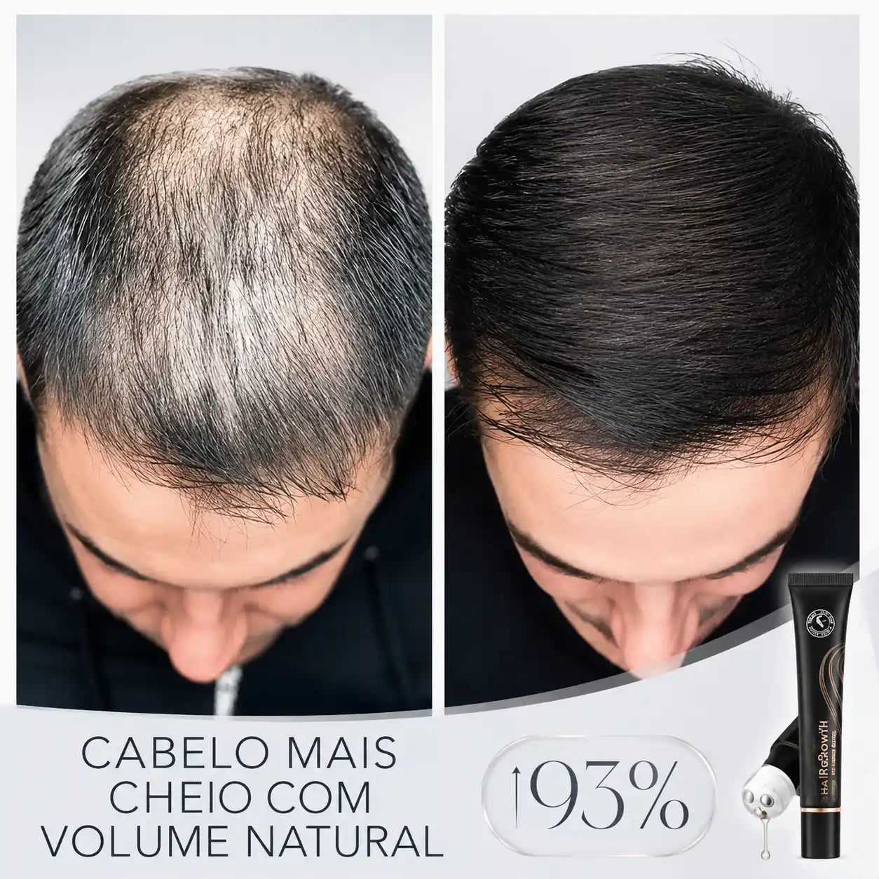 Repair Hair® - Crecimiento Capilar y Combate la Caída del Cabello
