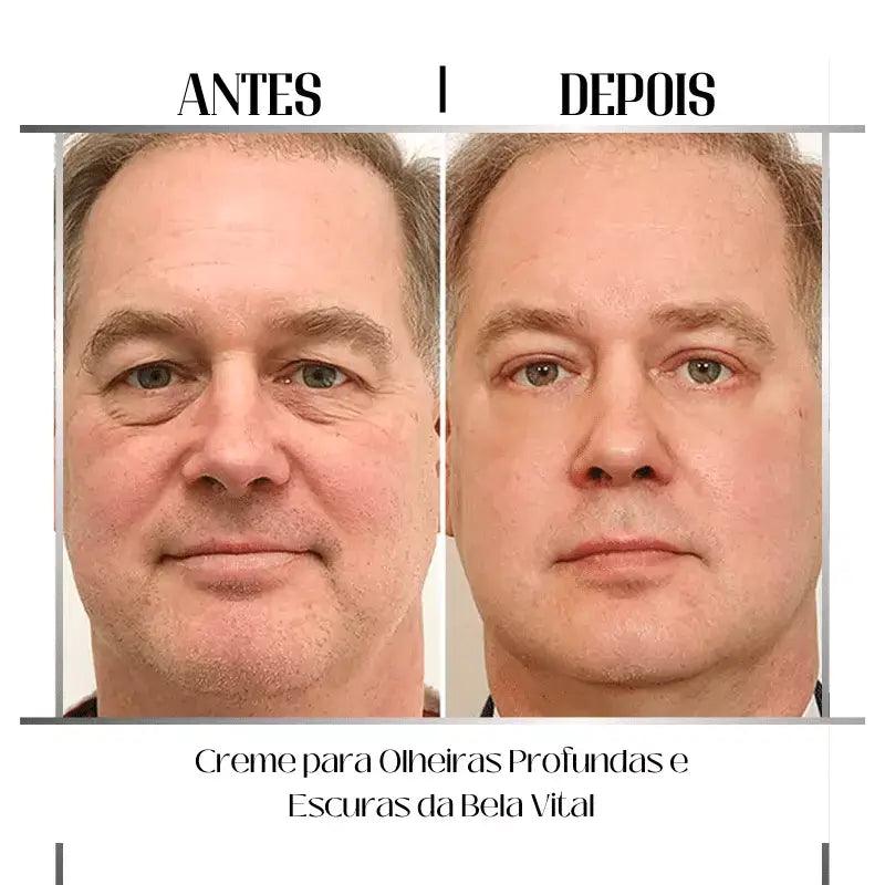 Crema para Ojeras Profundas y Oscuras