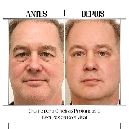 Crema para Ojeras Profundas y Oscuras